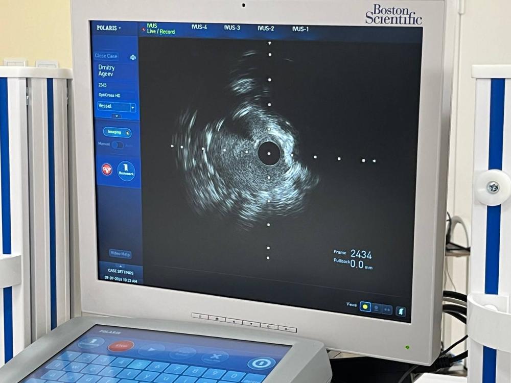 Нацпроект «Здравоохранение»: рентгенхирурги больницы Захарьина начали работу по внедрению технологии внутрисосудистого УЗИ